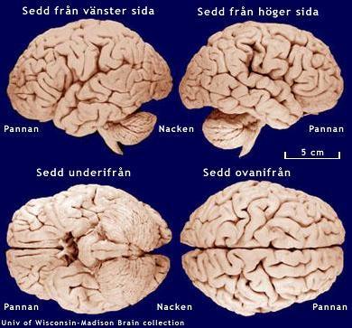 Människans hjärna