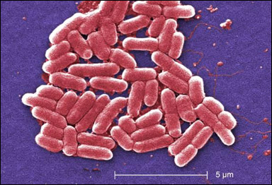 Kolibakterien (Escherichia coli)
