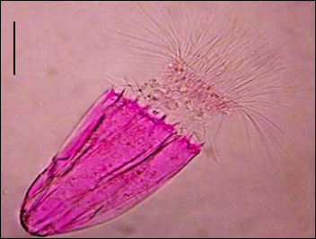 Anaerobt korsettdjur som saknar mitokondrier