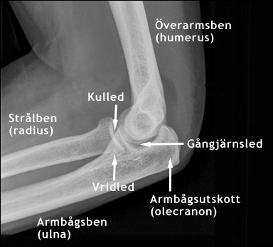 Röntgenbild av armbågslederna