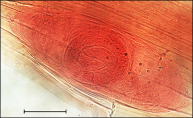 Trikin (Trichinella spiralis)